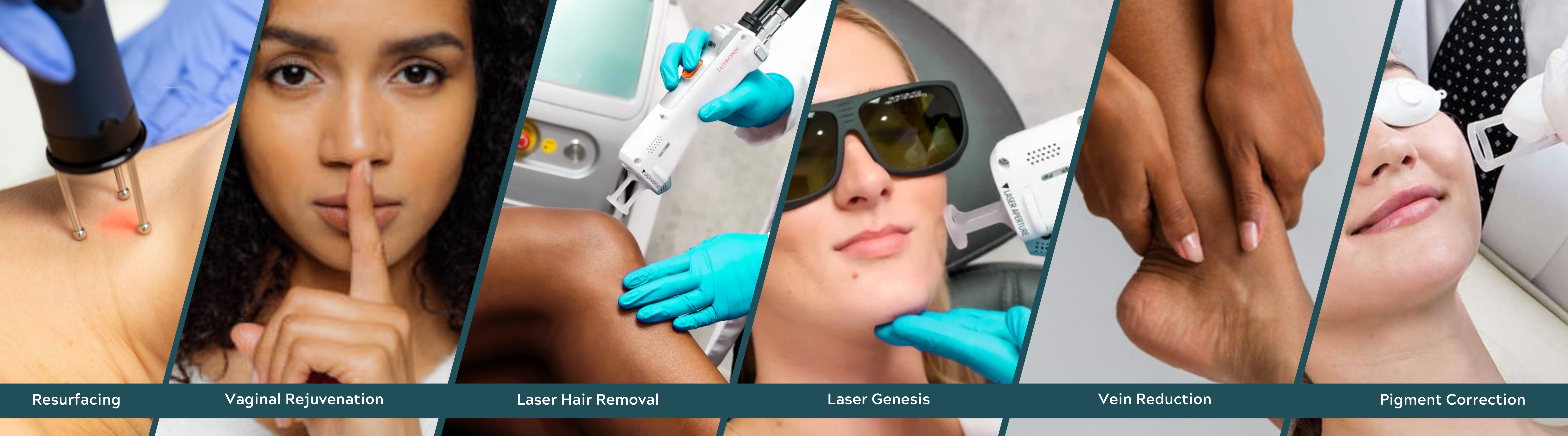 laser, Laser Services